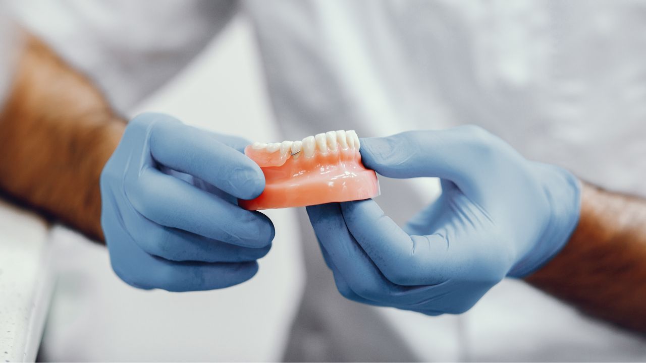 vantagens do implante dentário
