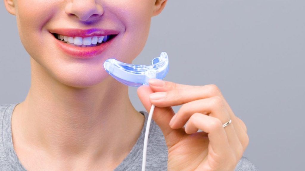 Clareamento dental com moldeira: saiba tudo sobre e cuidados!