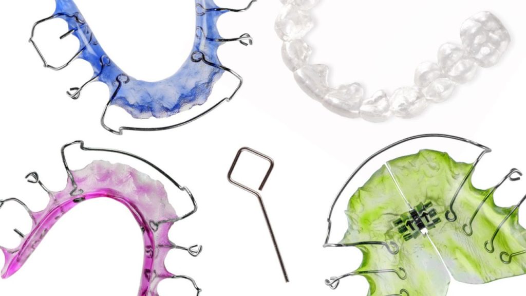 Conheça o que é aparelho móvel, seus tipos e para que serve