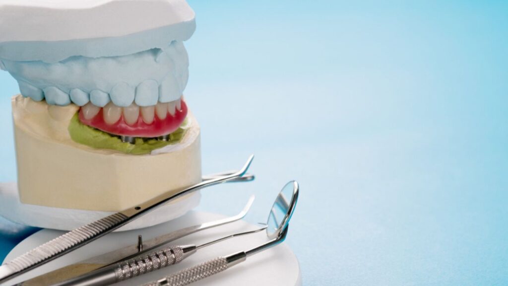 overdenture
