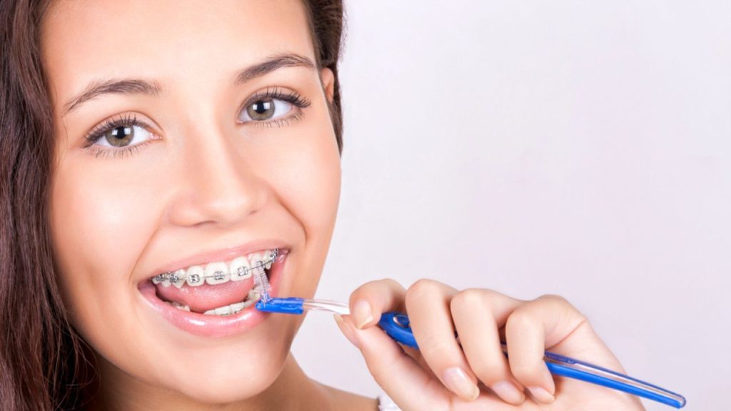 Escova de dente para quem usa aparelho: veja as melhores opções!