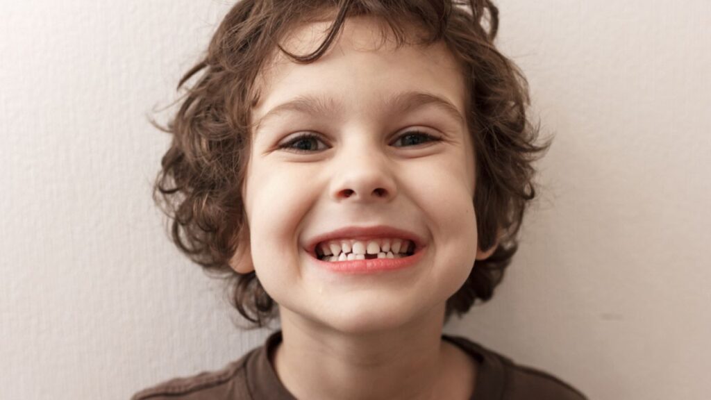 criança mostrando a troca dos dentes de leite pelos dentes permanentes