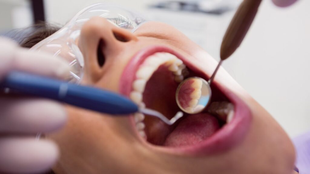 O que é restauração do dente: entenda tudo sobre!