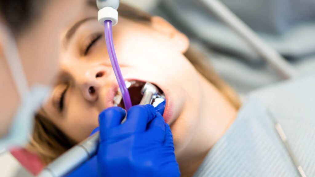 Aplicação de flúor: importância e como funciona! - OralDents
