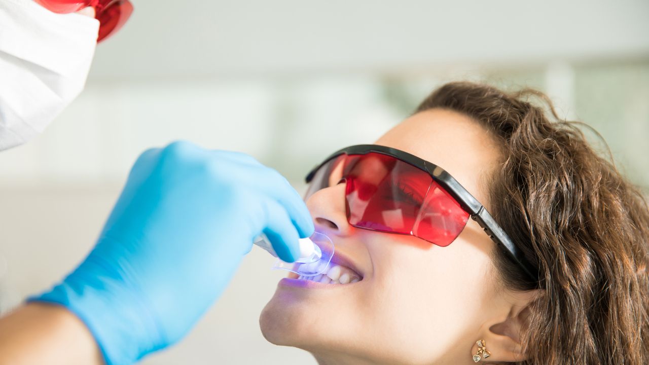 Clareamento dental