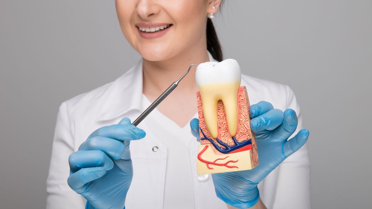 Como remover placa bacteriana e prevenir o tártaro Como remover placa bacteriana e prevenir o tártaro