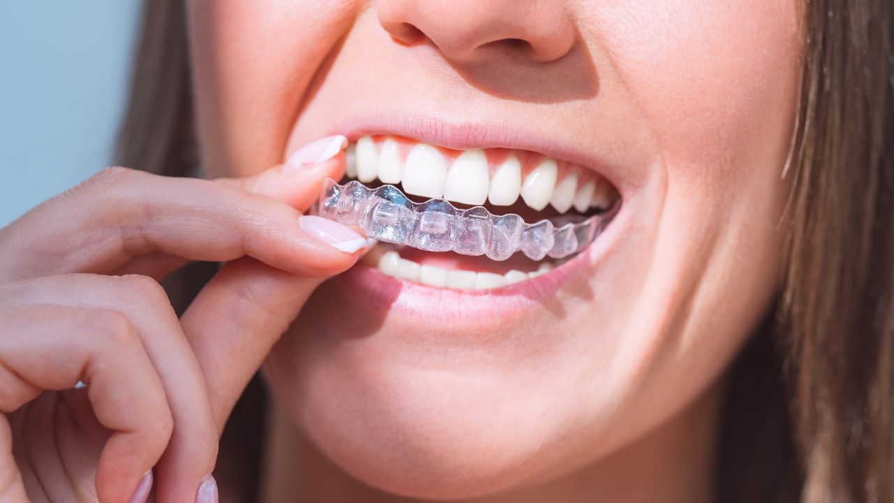 Consulta e avaliação profissional para decidir entre Invisalign e aparelho fixo Consulta e avaliação profissional para decidir entre Invisalign e aparelho fixo