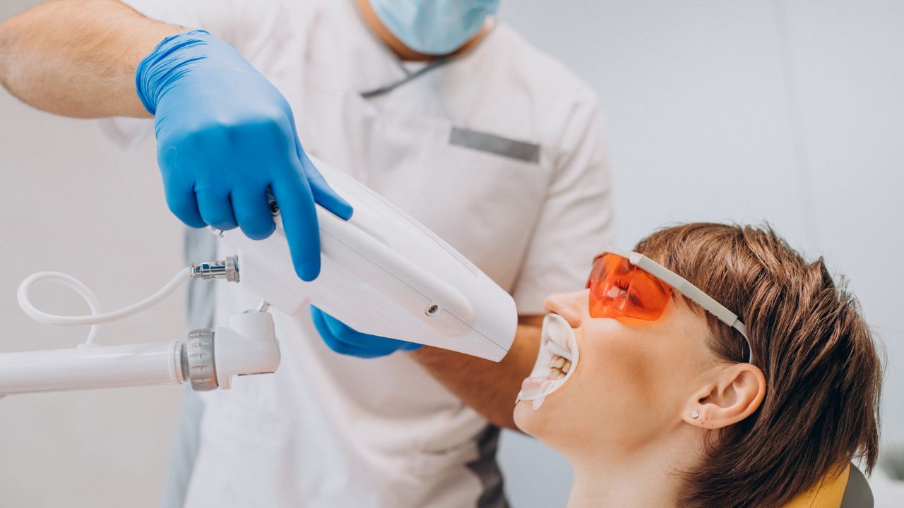 Indicações para clareamento e lentes de contato