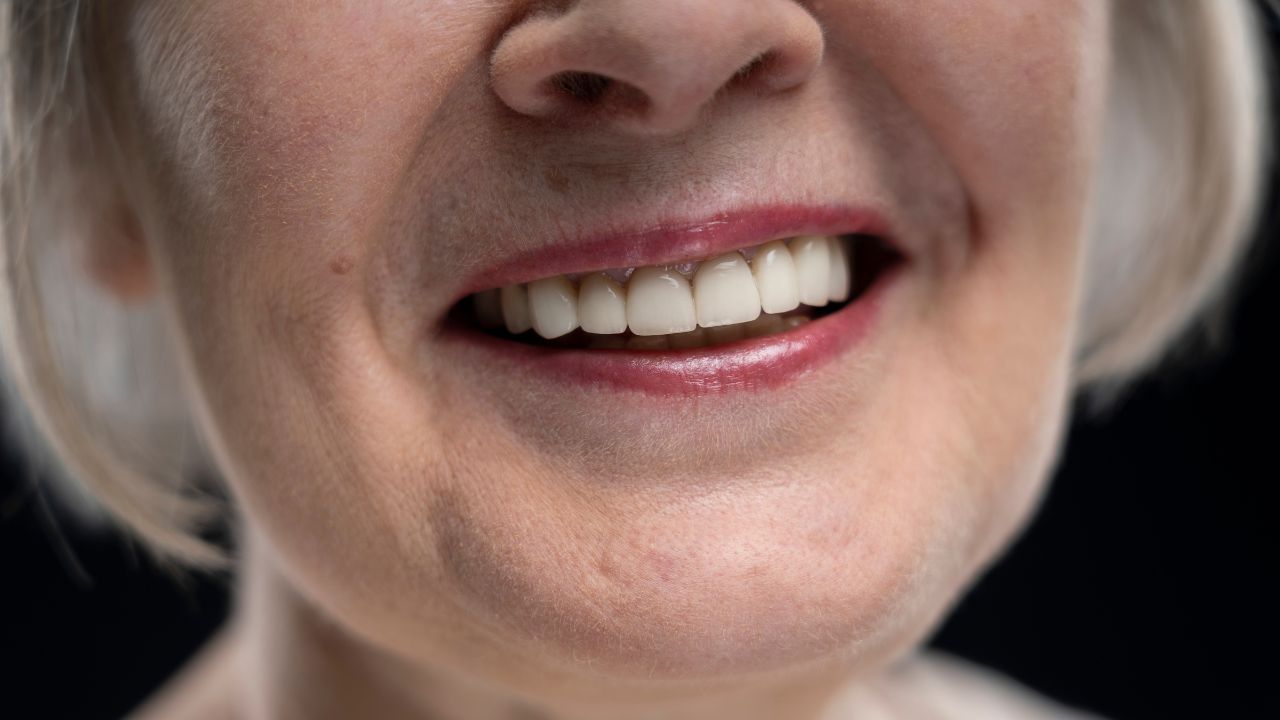 Fatores que aumentam risco de infecção no implante dentário