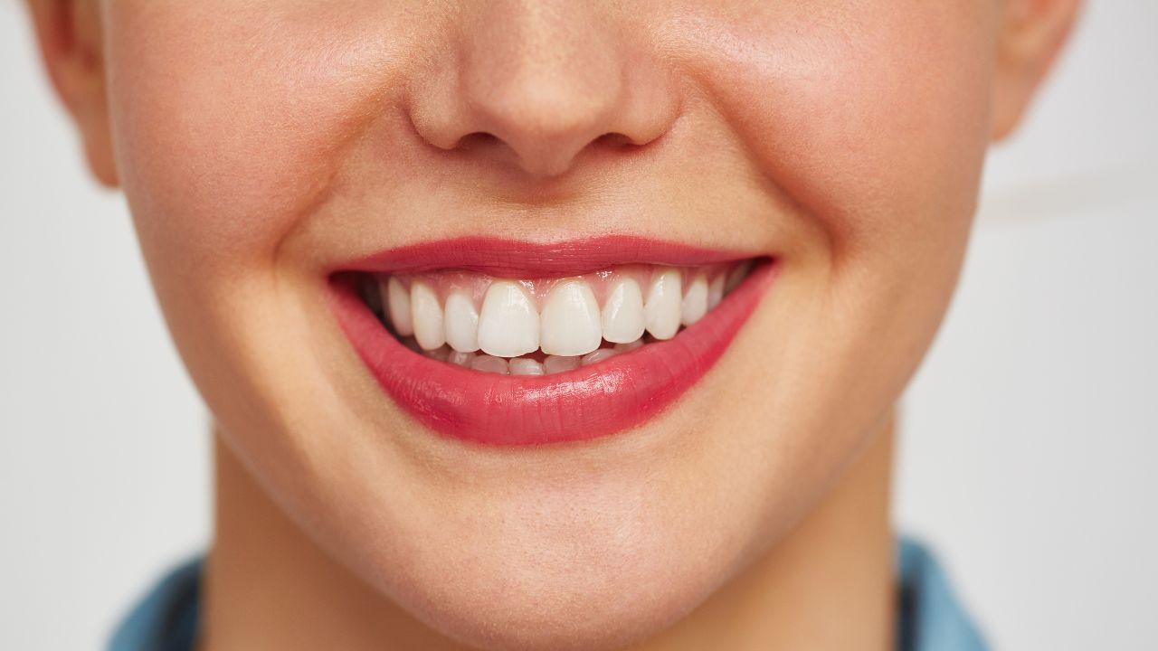 Como prevenir dentes amarelados